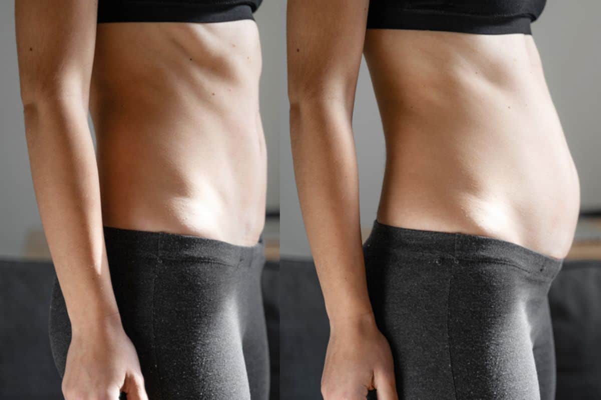 How long does diastasis recti take to improve Tamworth?