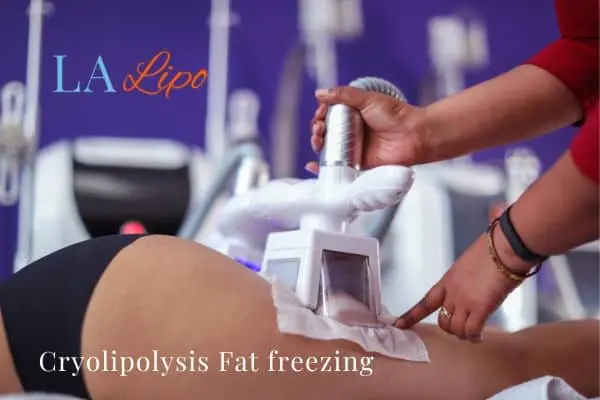 women getting fat freezing Tamworth