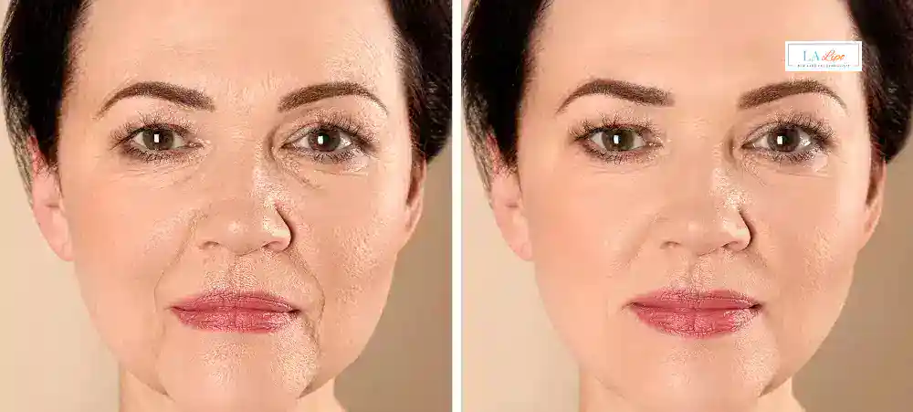Why Aren’t My Skincare Products Making My Sagging Skin Look Firmer Tamworth?