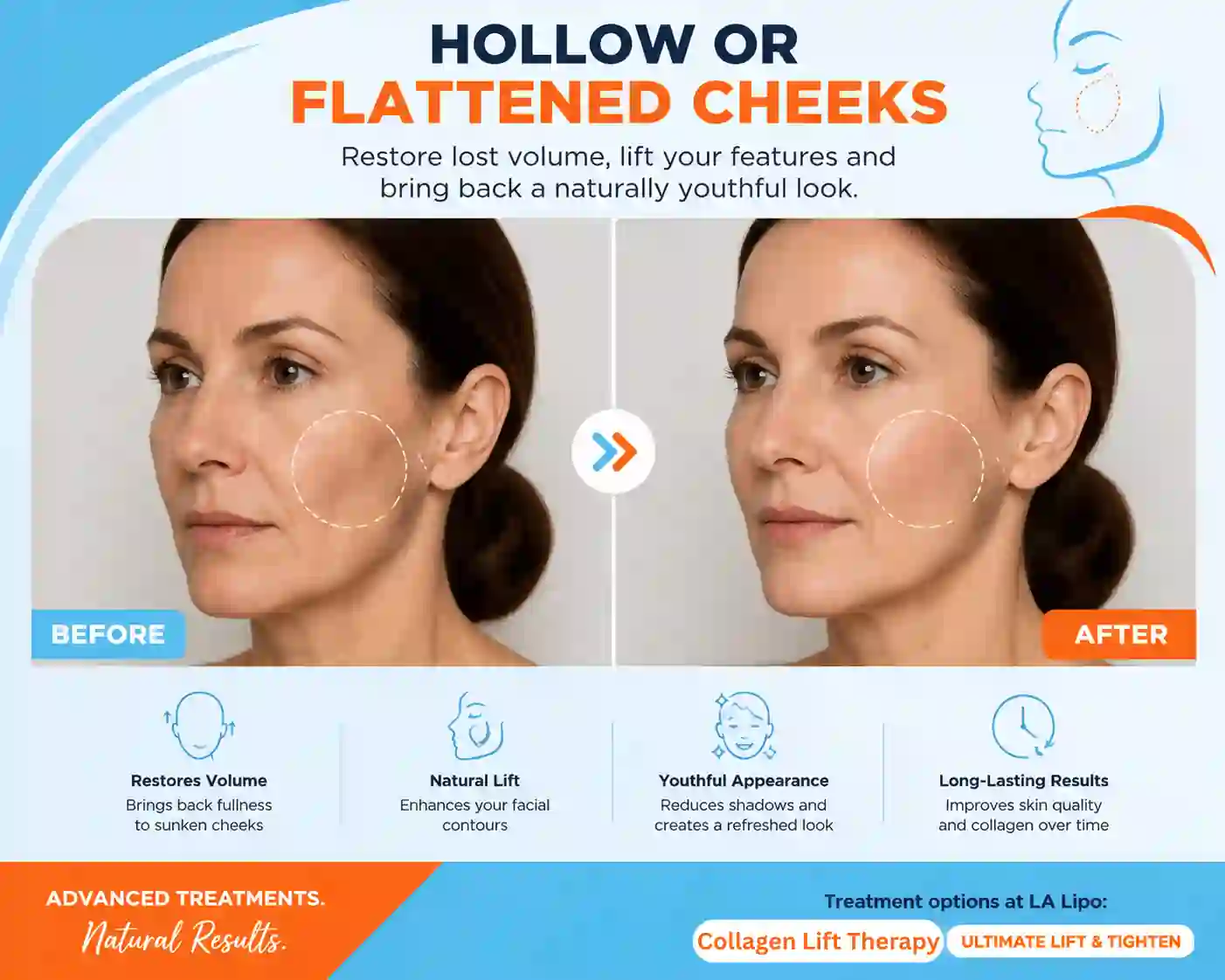 Sign #4: Hollow or Flattened Cheeks Tamworth