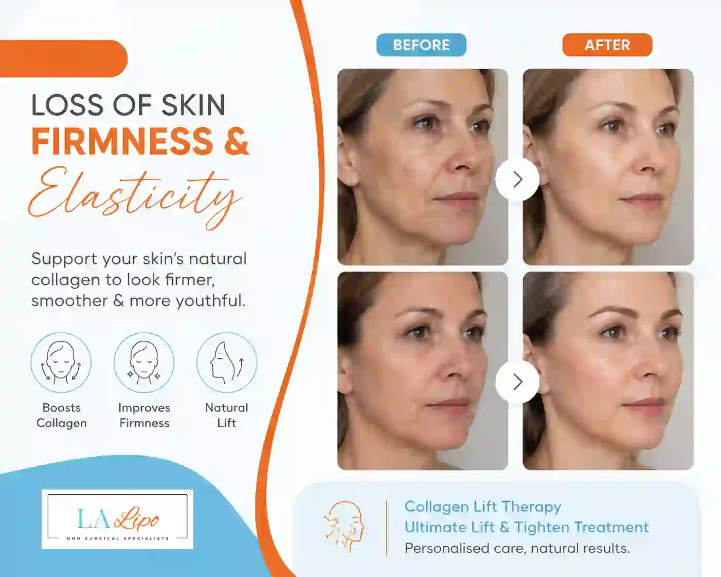 Sign #7: Loss of Skin Firmness and Elasticity Tamworth